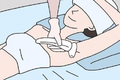 使用家用光子脫毛儀，你需要知道這幾點(diǎn)