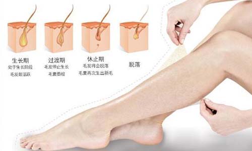 夏季脫毛：為什么有人說(shuō)光子脫毛沒(méi)有效果？(圖1)